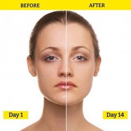 Chemist At Play Exfoliating Face Serum - 30ML (10% AHA + 1% Hyaluronic Acid) Chemist At Play Exfoliating Face Serum - 30ML (10% AHA + 1% Hyaluronic Acid)