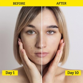 Chemist At Play Hydrating Face Serum - 30ML (11 KDa Hyaluronic Acid + 10% Niacinamide) Chemist At Play Hydrating Face Serum - 30ML (11 KDa Hyaluronic Acid + 10% Niacinamide)