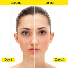 Chemist At Play Advanced Brightening Face Serum - 30ML (20% Vitamin C + 1% Tocopherol + 0.5% Ferulic Acid) Chemist At Play Advanced Brightening Face Serum - 30ML (20% Vitamin C + 1% Tocopherol + 0.5% Ferulic Acid)