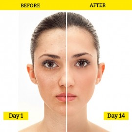 Chemist At Play Brightening Face Serum - 30ML (10% Vitamin C + 0.5% Hyaluronic Acid) Chemist At Play Brightening Face Serum - 30ML (10% Vitamin C + 0.5% Hyaluronic Acid)